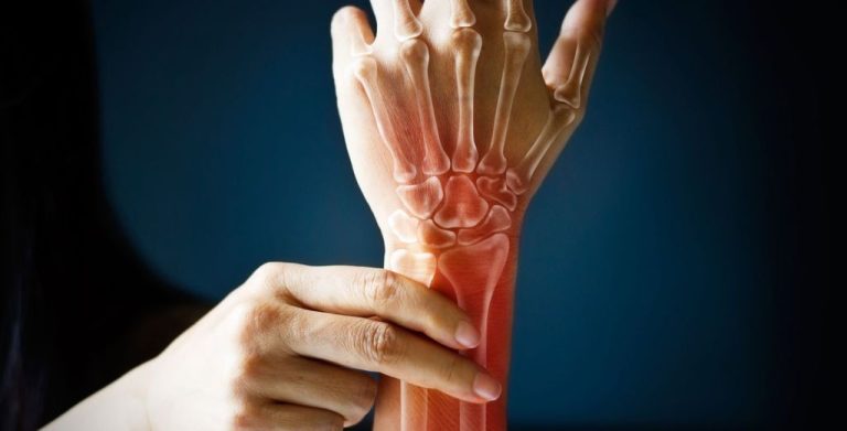 Nutrition and Athlete Bone Health